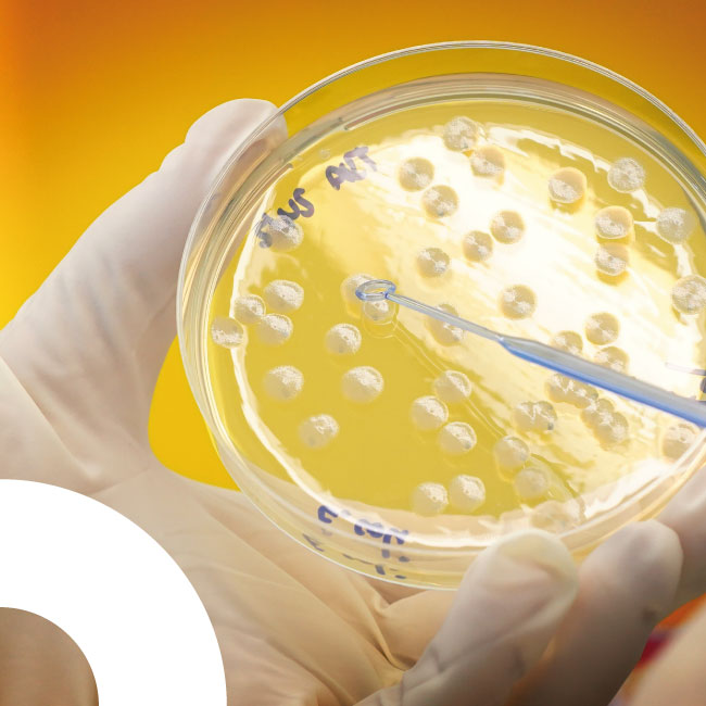 Capsula de petri
